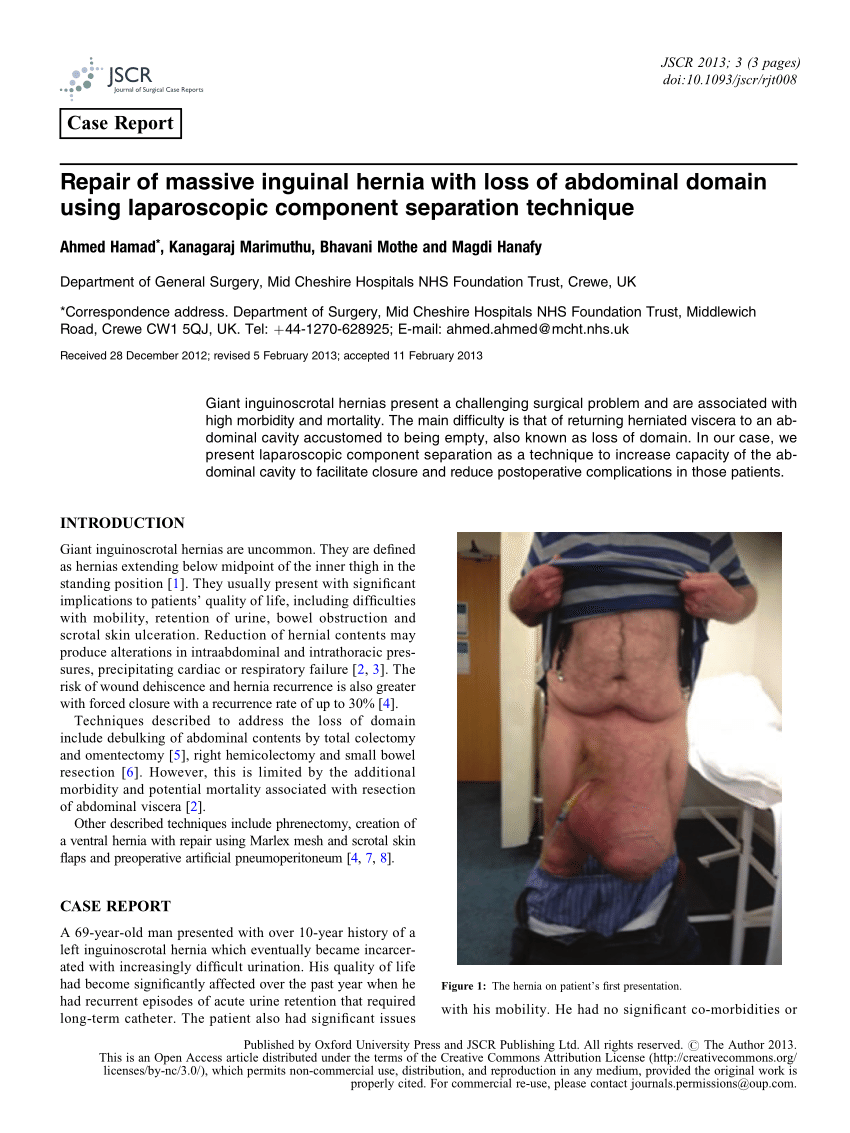 Single-incision totally extraperitoneal hernia repair with intraperitoneal  inspection of strangulated femoral hernia at risk for intestinal ischemia  after repositioning: a case report, Journal of Medical Case Reports