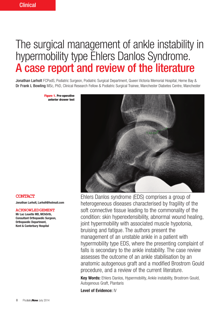 Grit Republic Net PDF) The management of lateral ankle instability in a patient with  hypermobility type Ehlers Danlos