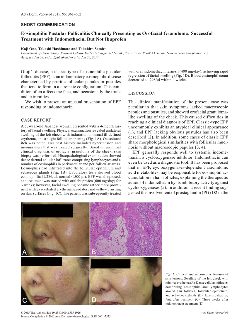 Pdf Eosinophilic Pustular Folliculitis Clinically Presenting As Orofacial Granuloma 