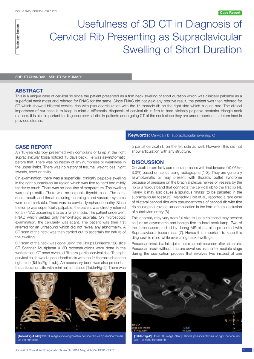 Pdf Usefulness Of 3d Ct In Diagnosis Of Cervical Rib Presenting As