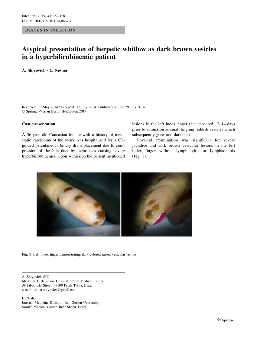 Nail Paronychia | PDF | Nail (Anatomy) | Wound