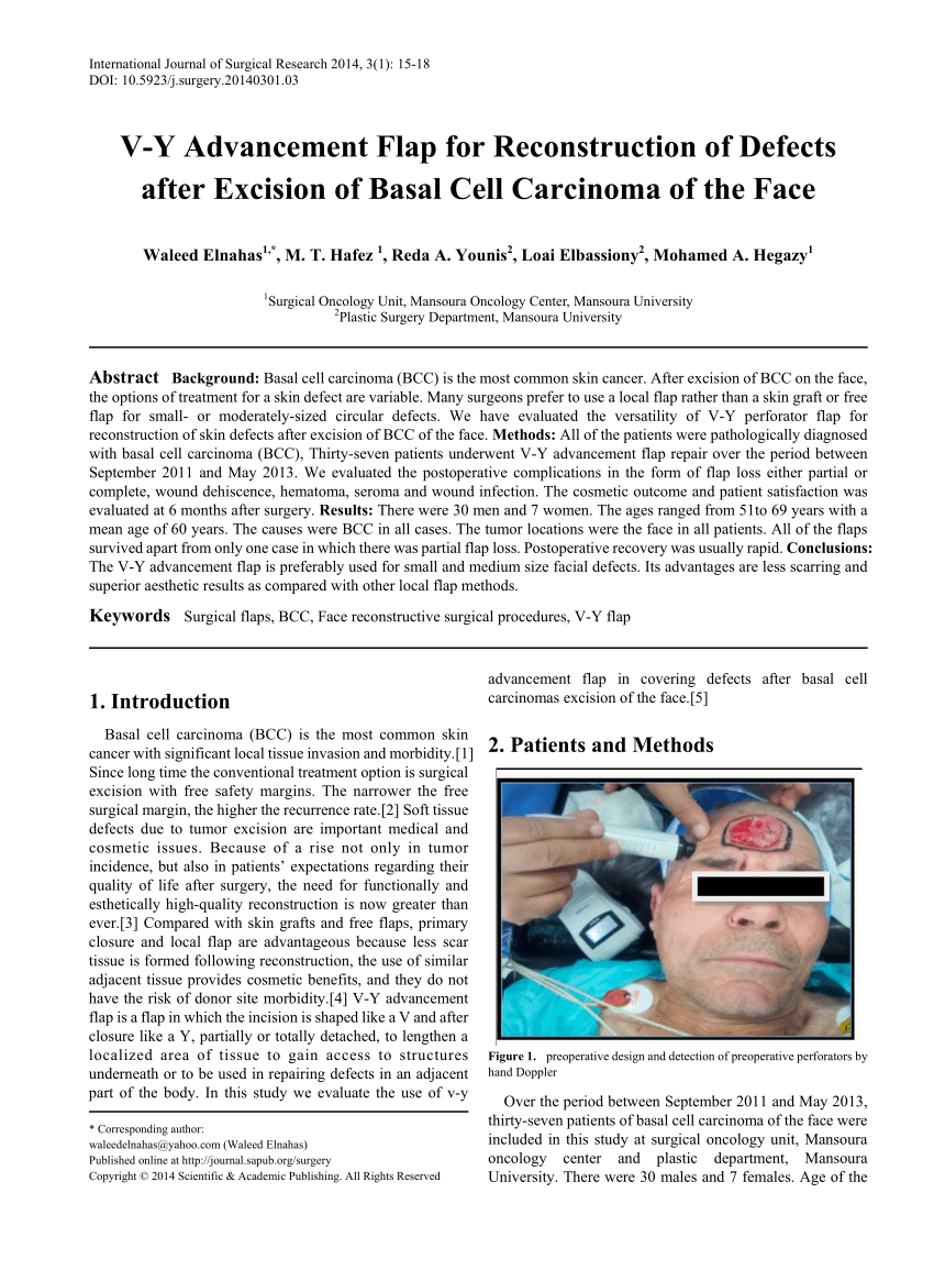 Pdf V Y Advancement Flap For Reconstruction Of Defects After Excision Of Basal Cell Carcinoma Of The Face