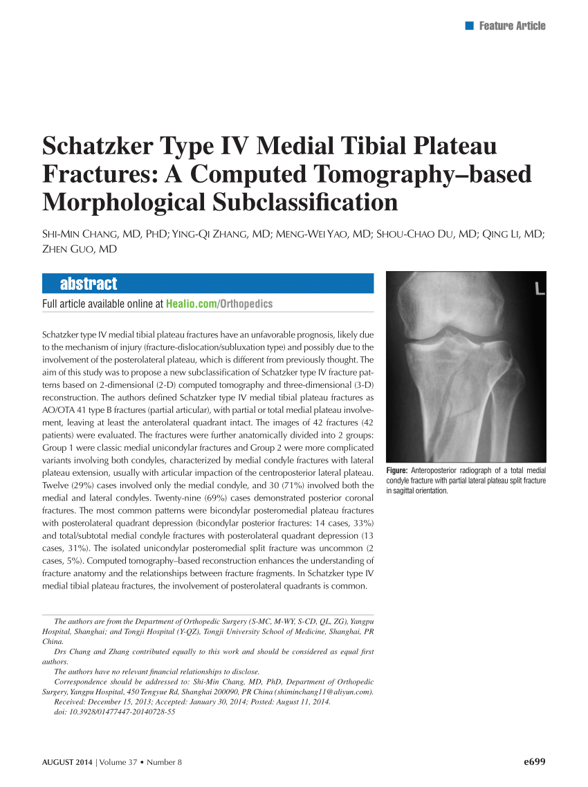 The Schatzker Classification System Of Tibial Plateau 8306