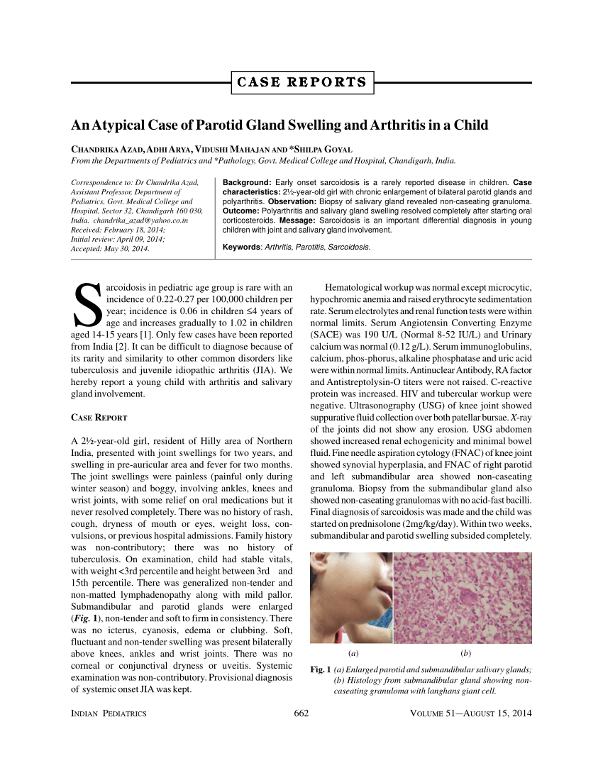 Pdf An Atypical Case Of Parotid Gland Swelling And Arthritis In A Child