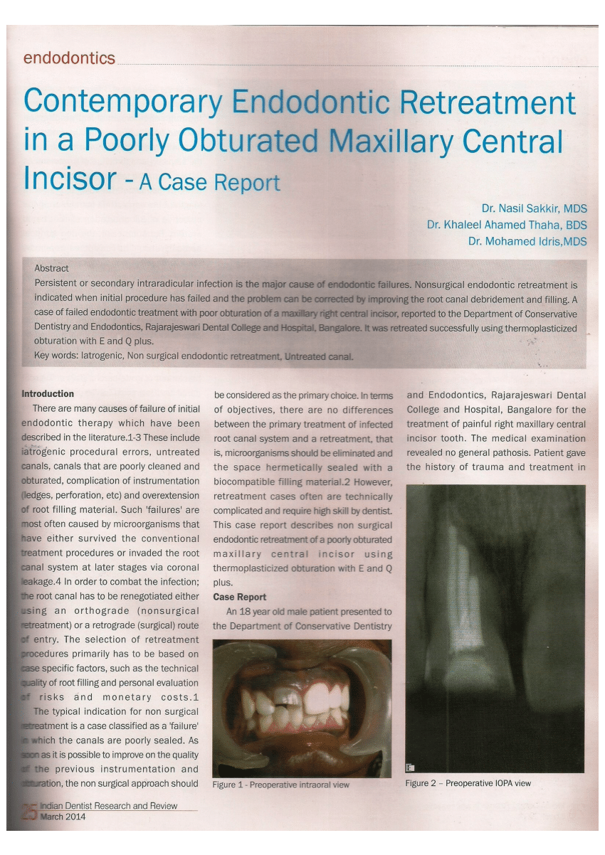 PDF Contemporary Endodontic Retreatment In A Poorly Obturated Maxillary Central Incisor A