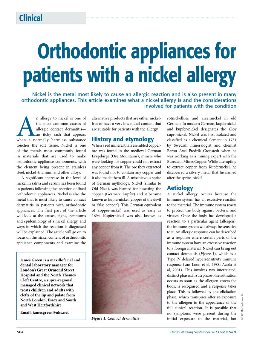 Pdf Orthodontic Appliances For Patients With A Nickel Allergy