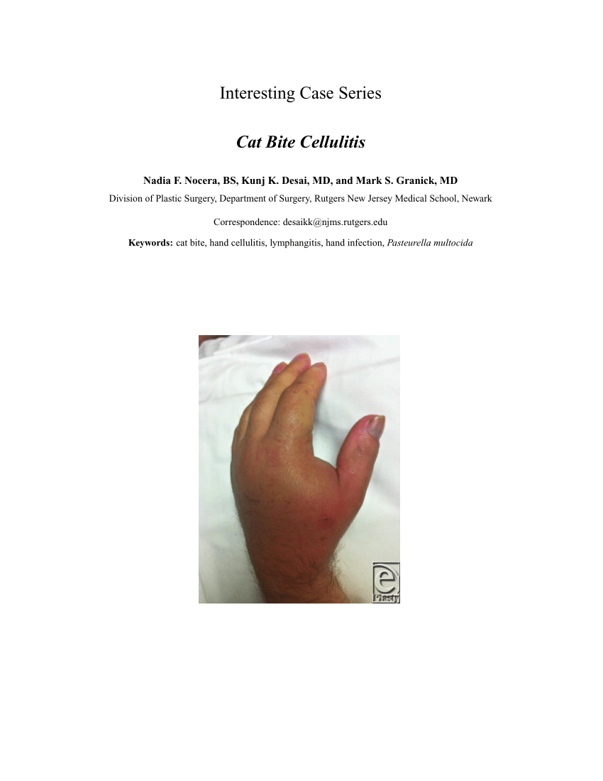 (PDF) Cat Bite Cellulitis