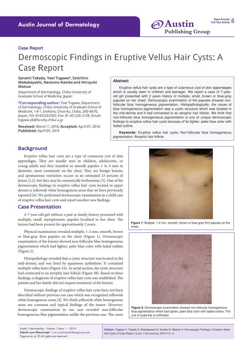 A Clinical appearance of eruptive vellus hair cysts of the labia   Download Scientific Diagram
