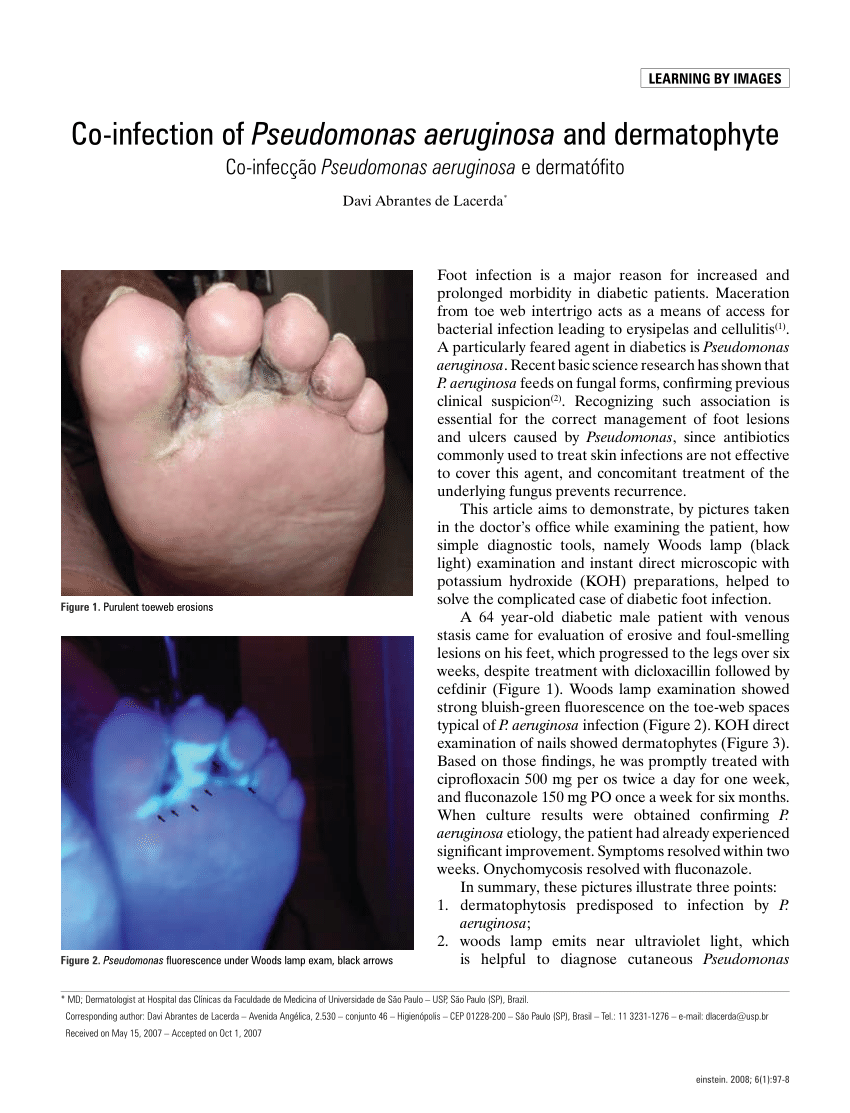 Cureus | Non-Melanoma-Associated Dyschromia of the Proximal Nail Fold |  Article