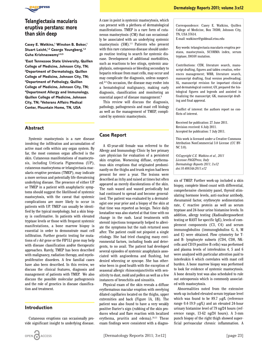 Anaphylaxis And Systemic Mastocytosis