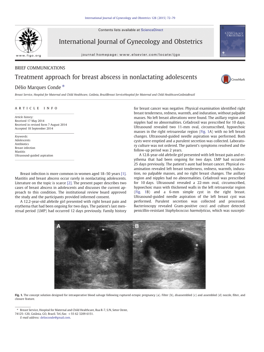 https://i1.rgstatic.net/publication/266204783_Treatment_approach_for_breast_abscess_in_nonlactating_adolescents/links/5ba6d9dc45851574f7dfc0bf/largepreview.png