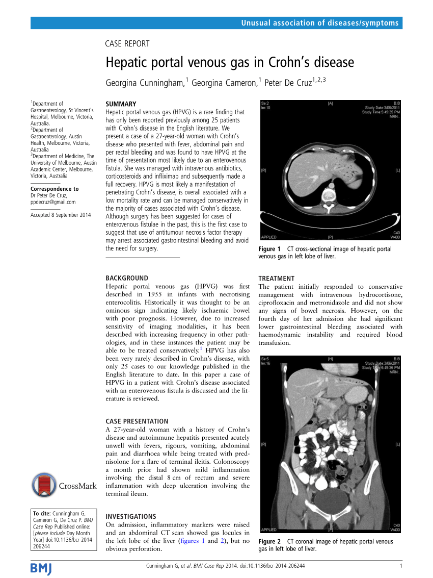 Pdf Hepatic Portal Venous Gas In Crohns Disease