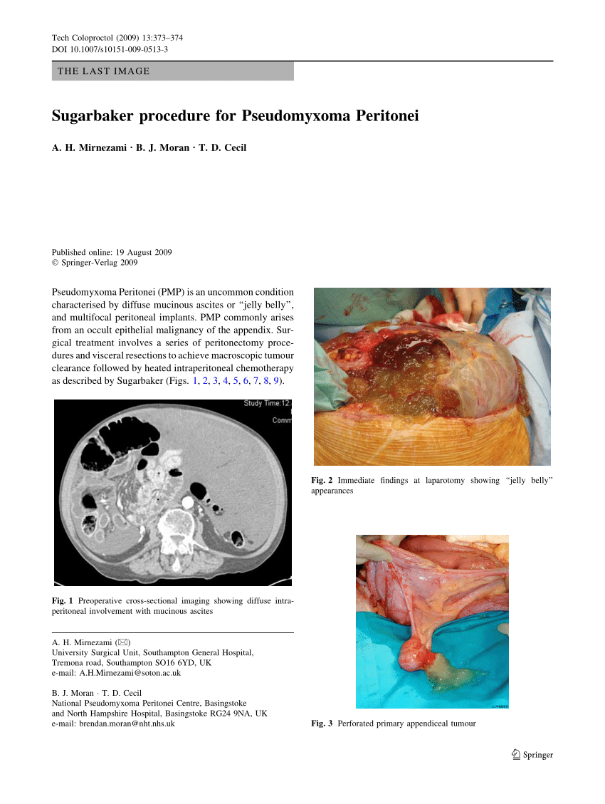 Peritoneal cancer medscape