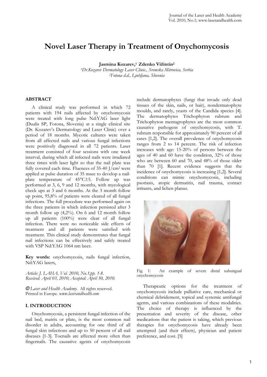 Effective Laser for Fungal Nails | Blue Mountains Podiatry