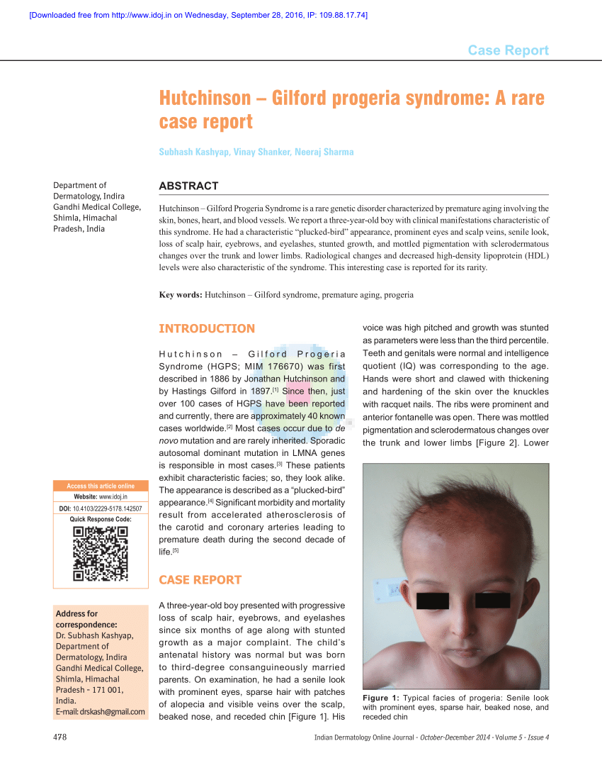 research papers on progeria