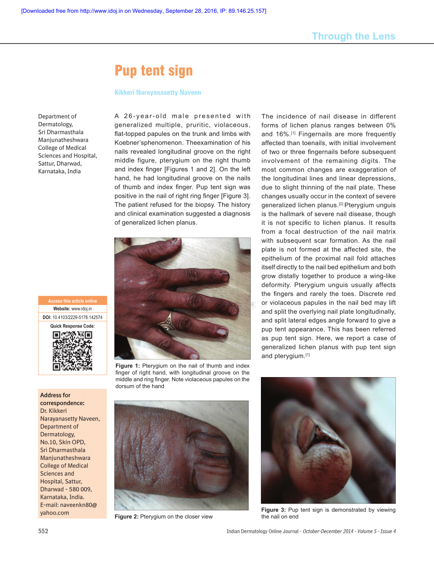 Clinical features and treatment outcomes of nail lichen planus: A  retrospective study