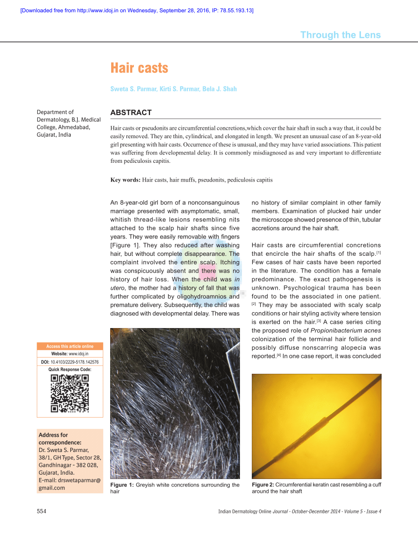 PDF) Hair casts