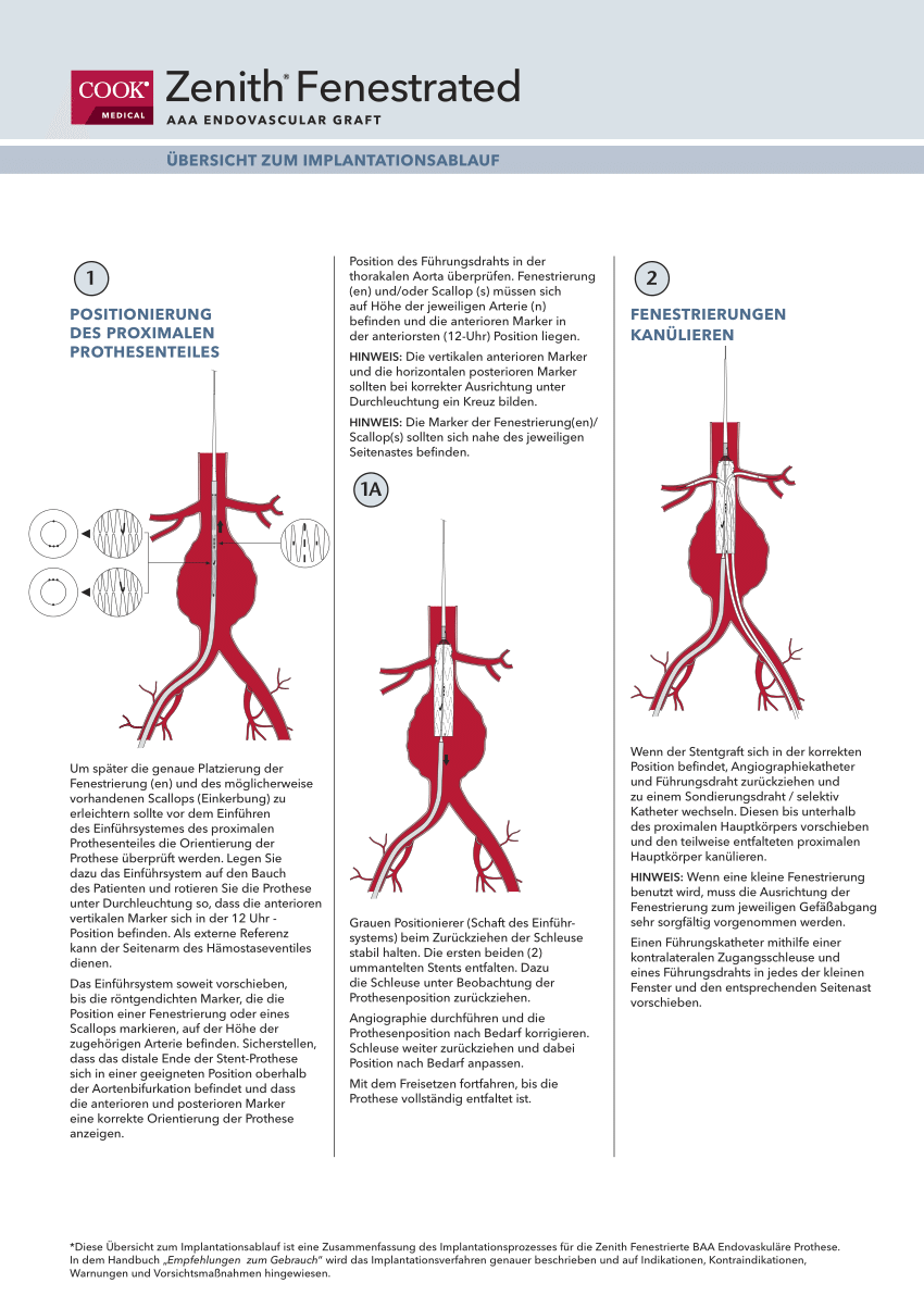 PDF Clinical impact of hypogastric artery occlusion in