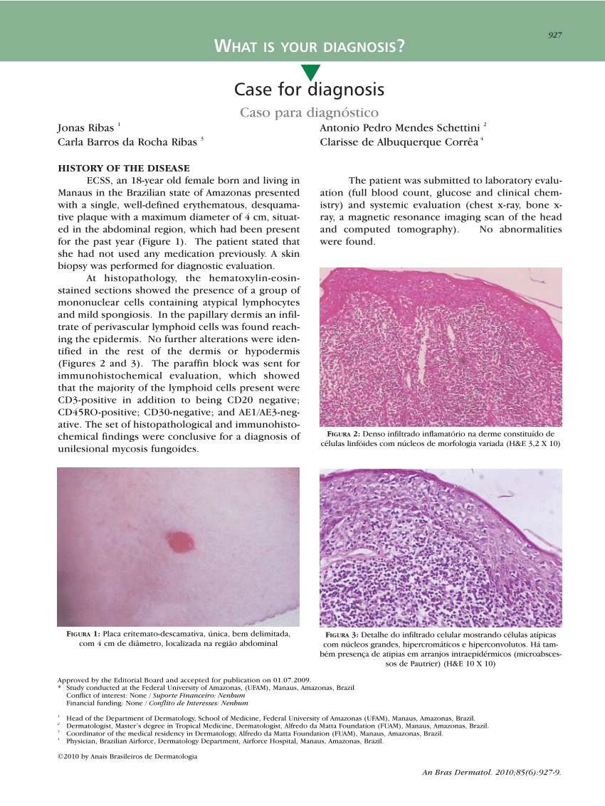 PDF) Laboratório de Histopatologia Cutânea do Serviço de Dermatologia do  Hospital de Santa Maria. Actividade de Doze Anos (2008-2019) - Parte II:  Patologia Não Tumoral