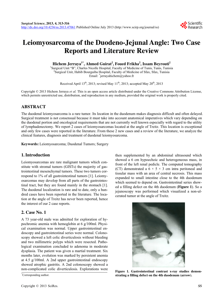 leiomyosarcoma case report and literature review