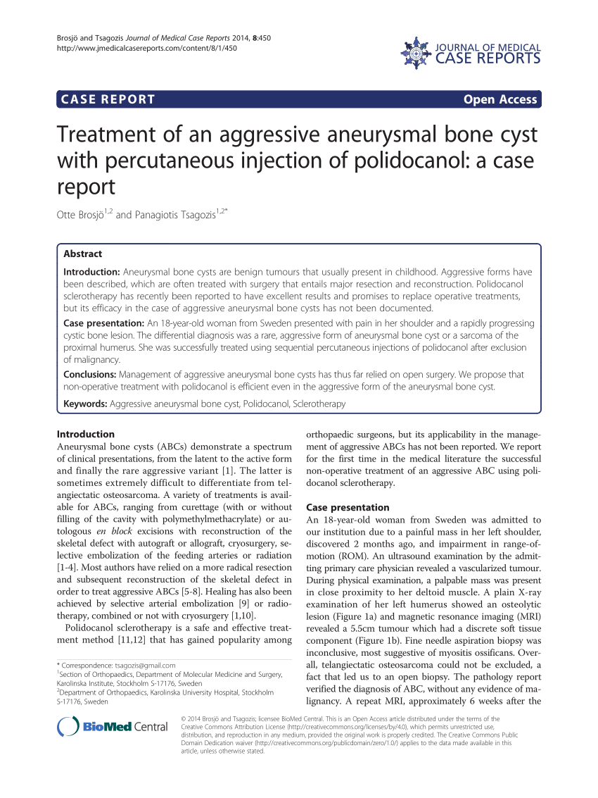 Pdf Treatment Of An Aggressive Aneurysmal Bone Cyst With Percutaneous Injection Of Polidocanol 2895