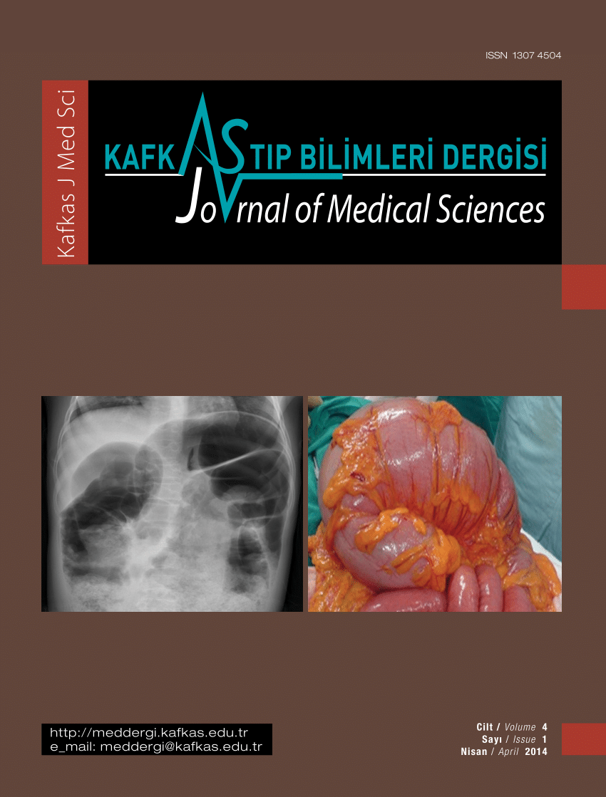 PDF Isolated adult hypoganglionosis resulting in toxic megacolon  