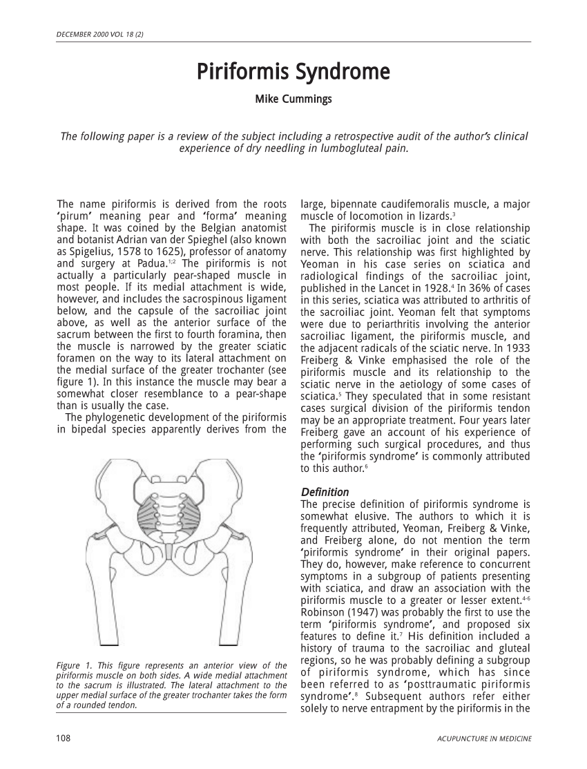 Piriformis Syndrome Chicago, Carpal Tunnel Syndrome