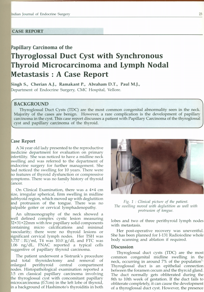 Pdf Papillary Carcinoma Of The Thyroglossal Duct Cyst With
