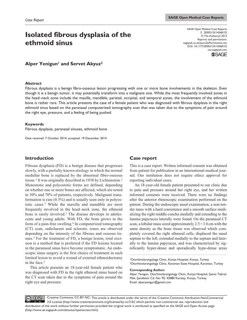 Pdf Isolated Fibrous Dysplasia Of The Ethmoid Sinus 2377