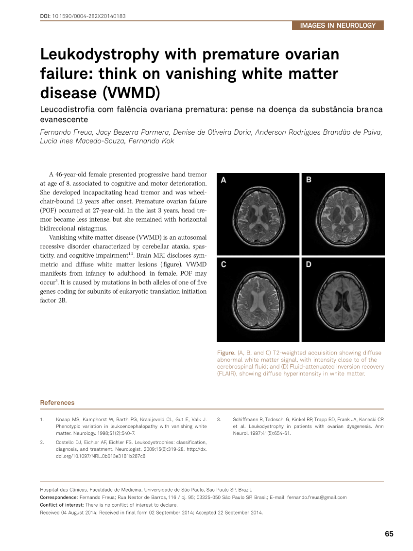 (PDF) Leukodystrophy with premature ovarian failure: Think on vanishing