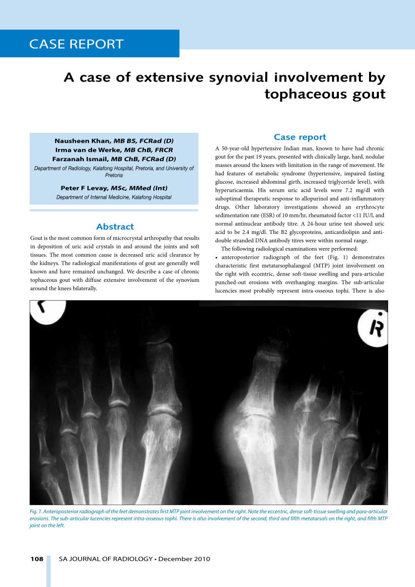 case study on gout