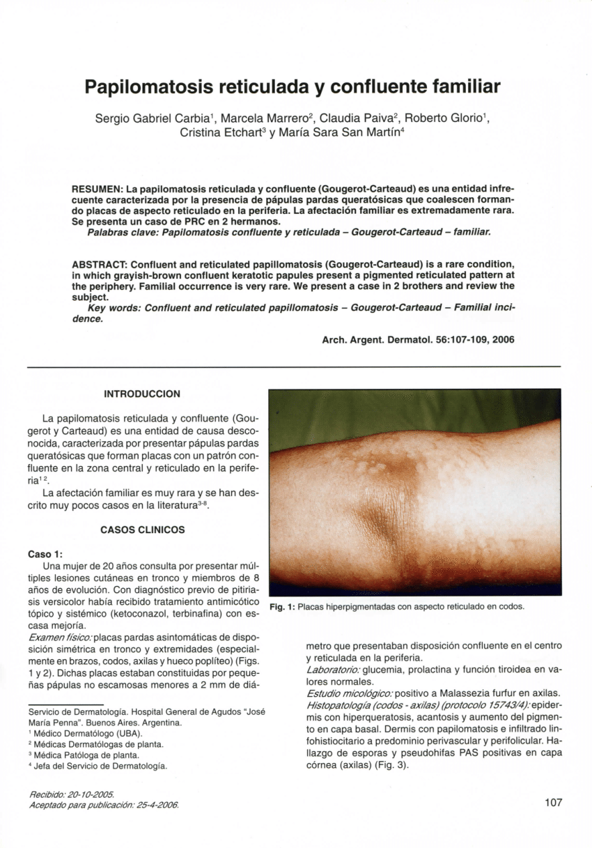 Papilomatosis reticulada tratamiento - Trat Seghnp - PDF Free Download