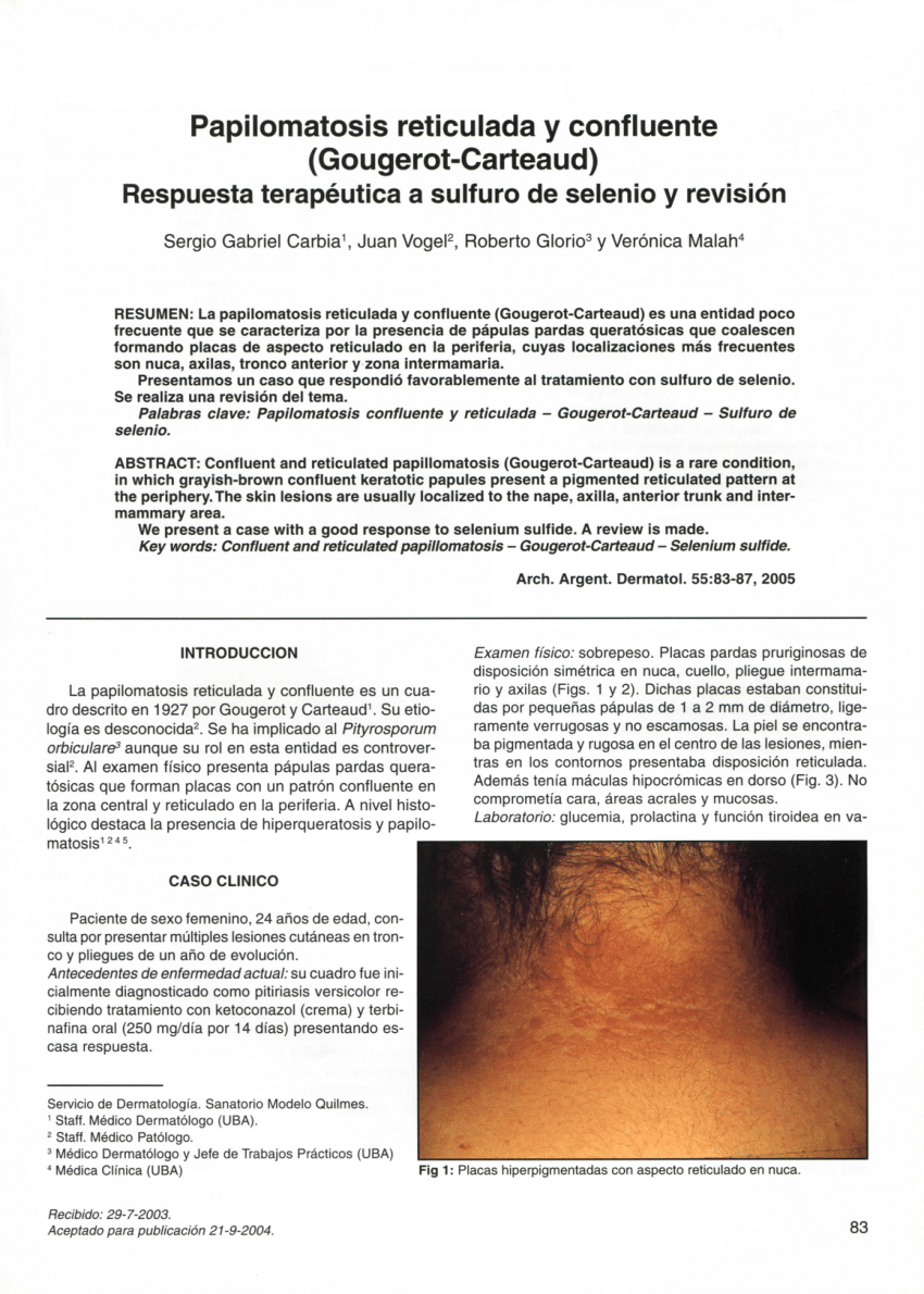 Causes of papillomatosis, Causes of papillomatosis. Papillomatosis causes