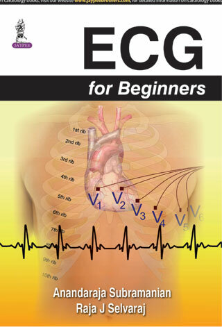 Pdf Ecg For Beginners