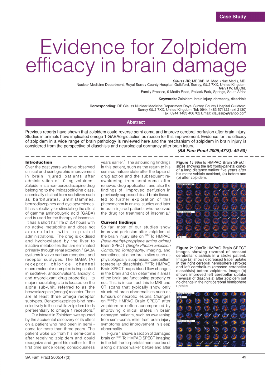 Injury in anoxic brain ambien use