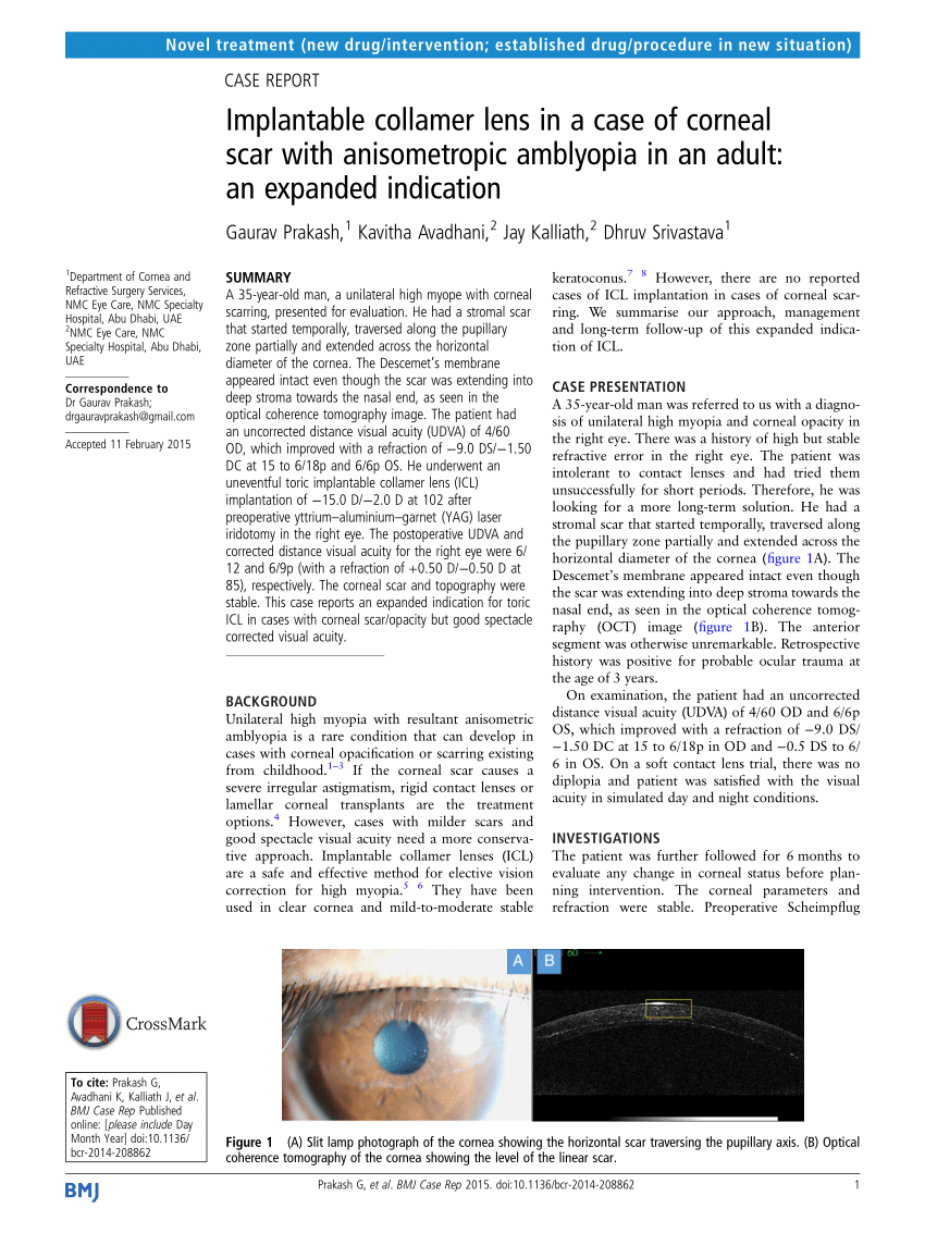 Pdf Implantable Collamer Lens In A Case Of Corneal Scar With