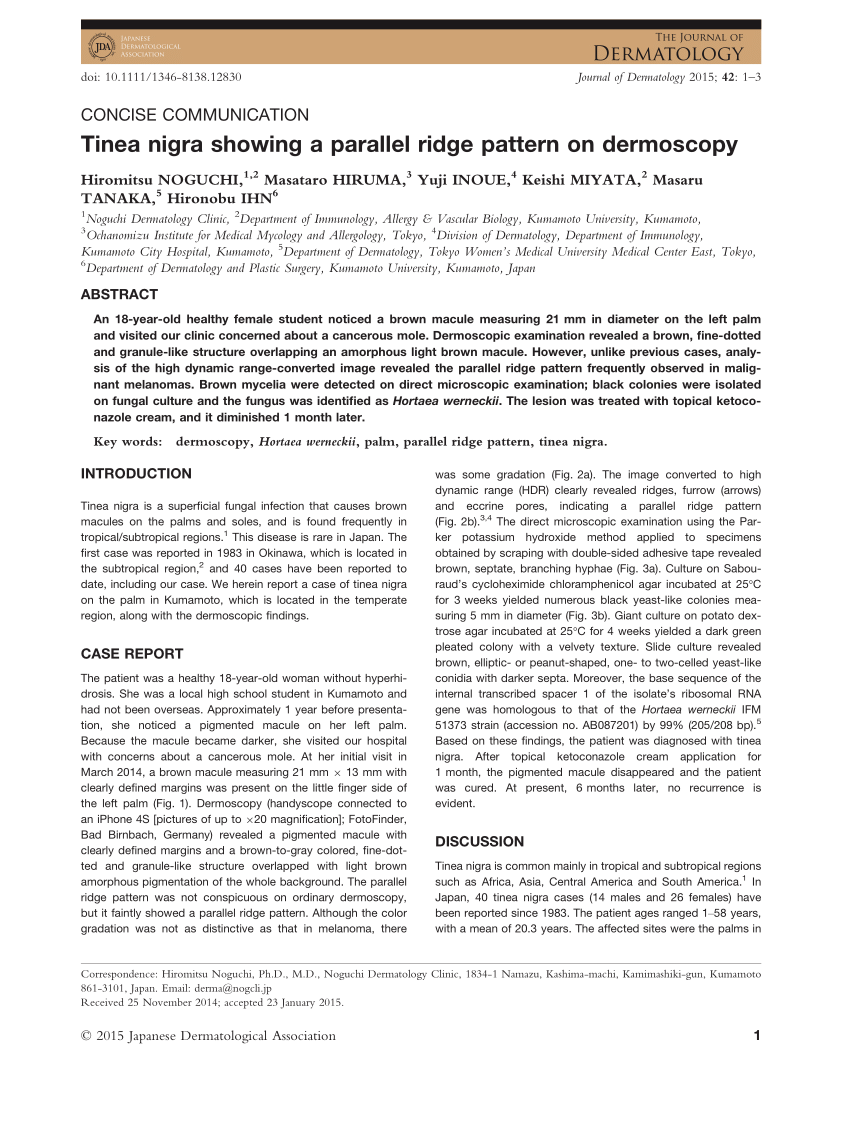 PDF) Tinea nigra showing a parallel ridge pattern on dermoscopy