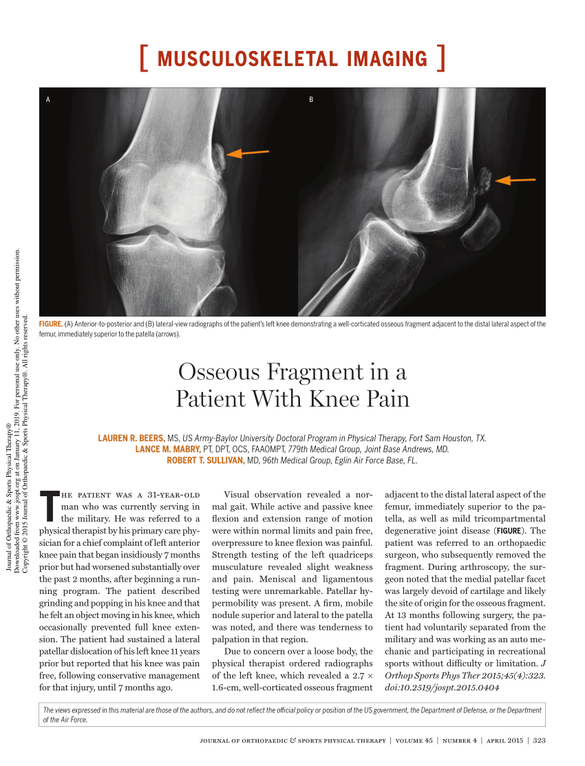 bone fragments in knee