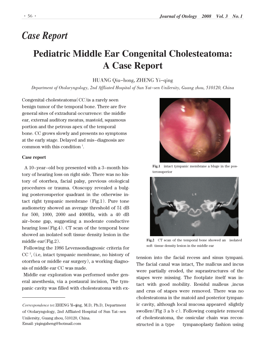 Congenital Cholesteatoma In Children