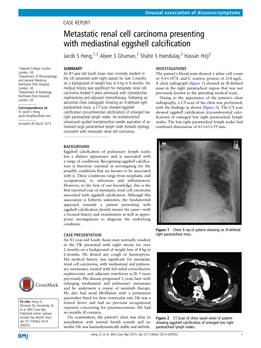 Pdf Metastatic Renal Cell Carcinoma Presenting With Mediastinal Eggshell Calcification