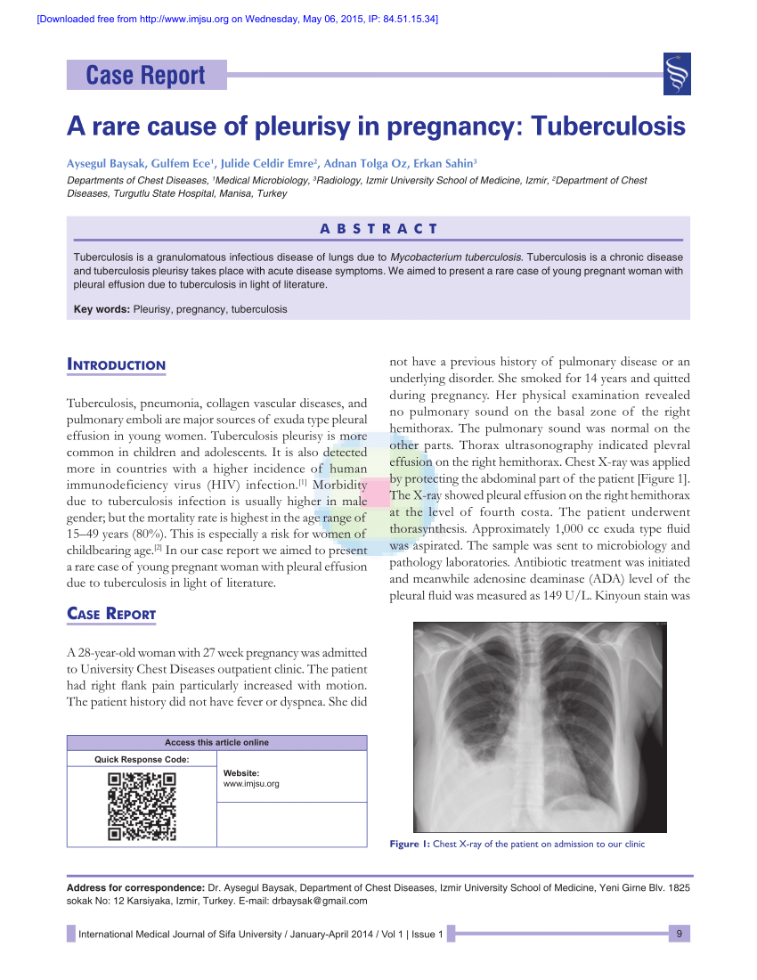 Pleurisy while pregnant