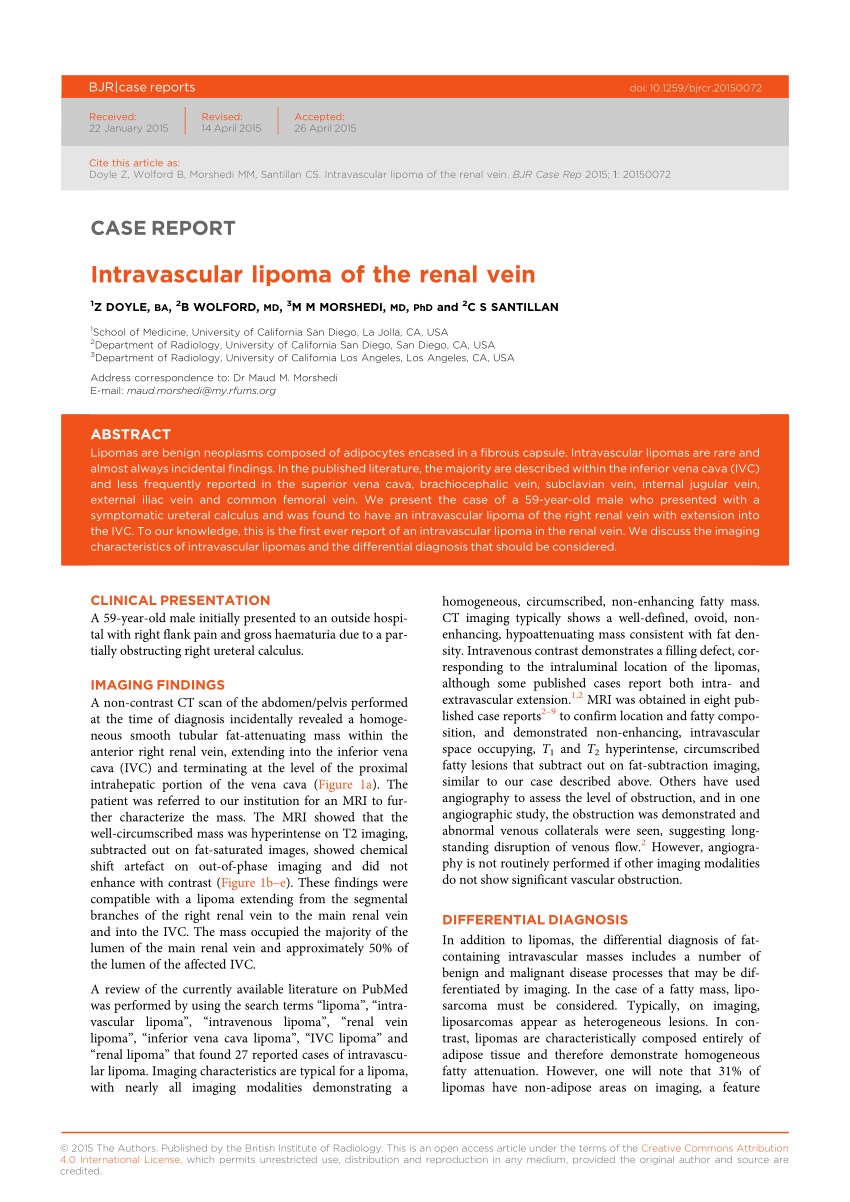 PDF Intravascular Lipoma of the Renal Vein