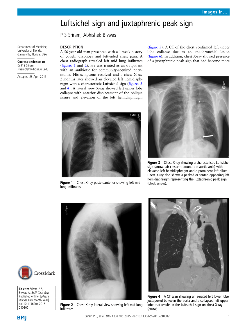 Chest imaging using signs, symbols, and naturalistic images: a practical  guide for radiologists and non-radiologists