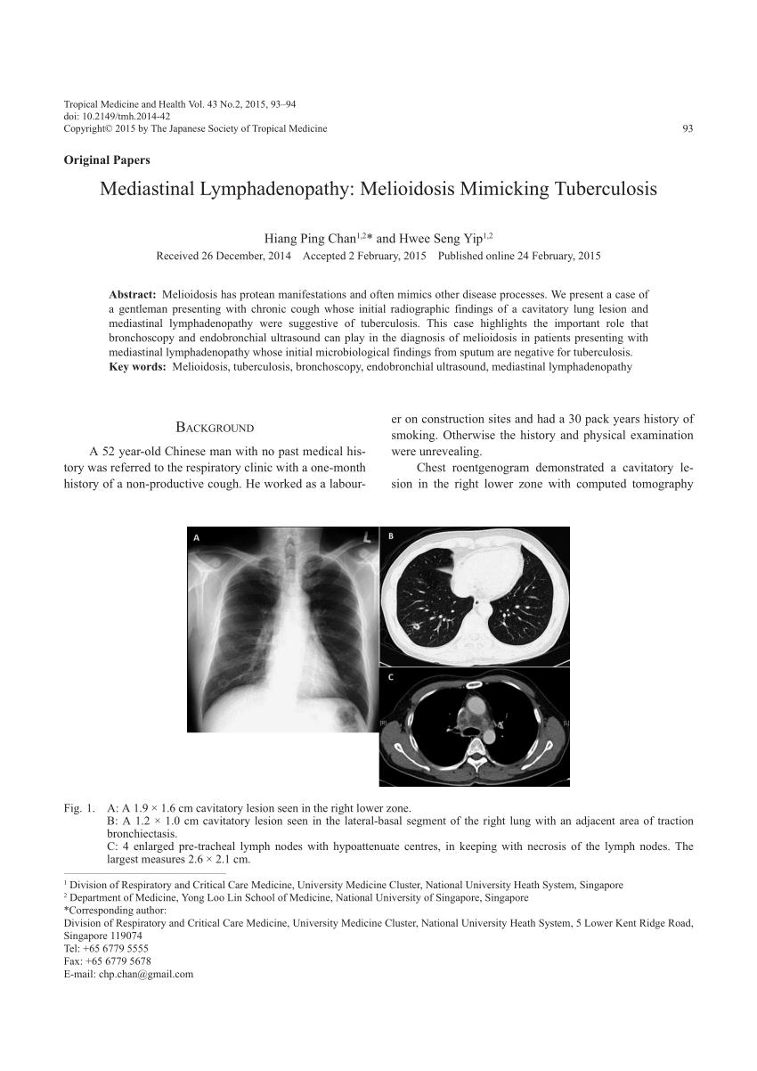 Pdf Mediastinal Lymphadenopathy Melioidosis Mimicking Tuberculosis