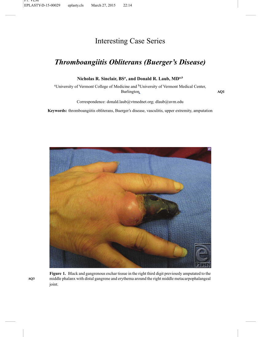 (PDF) Thromboangiitis Obliterans (Buerger's Disease)