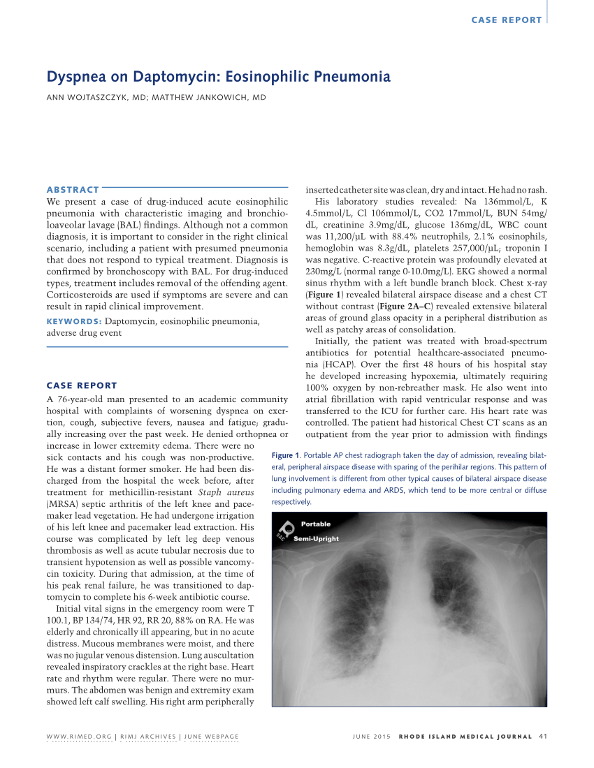 Pdf Dyspnea On Daptomycin Eosinophilic Pneumonia