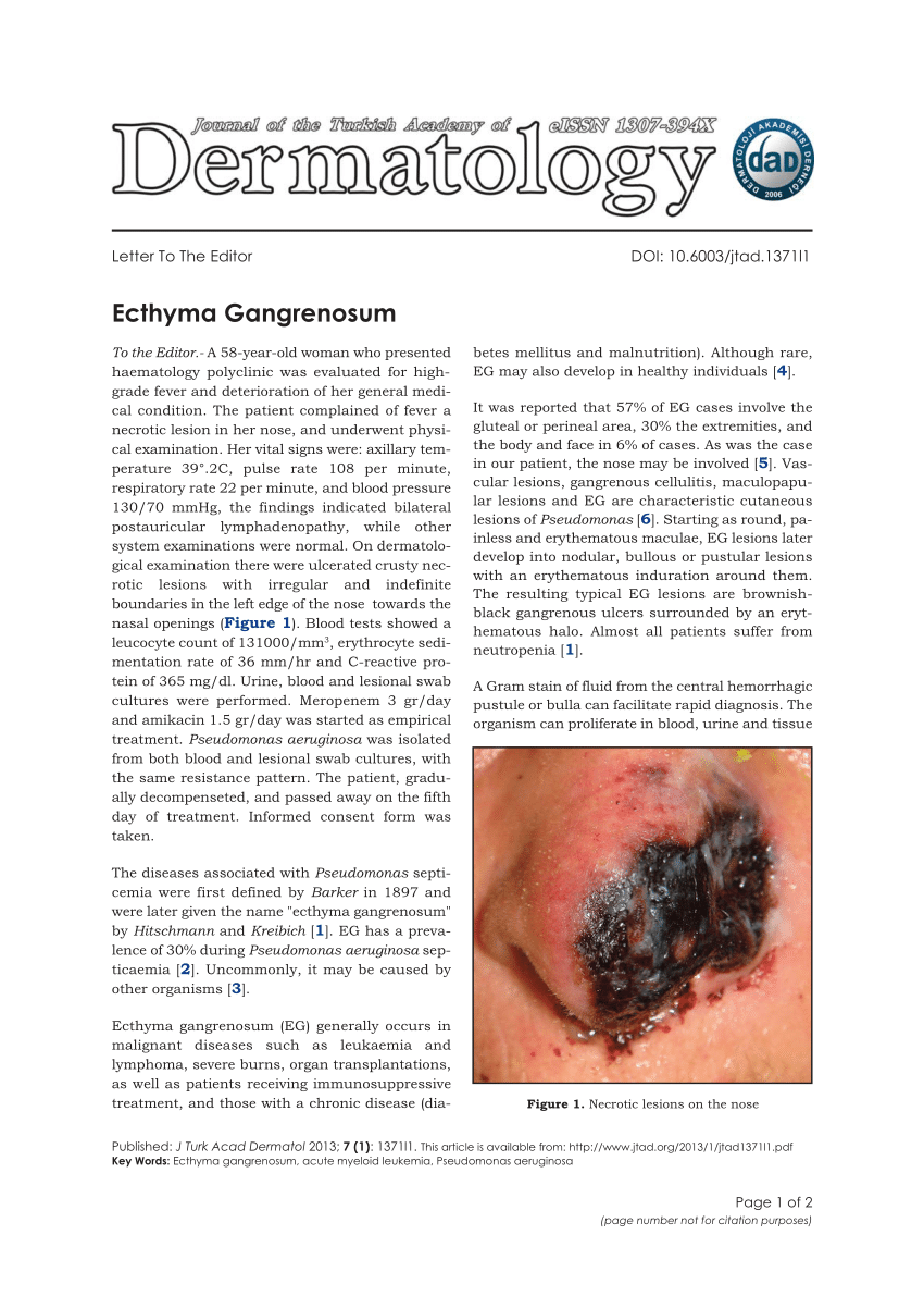 ecthyma gangrenosum histology