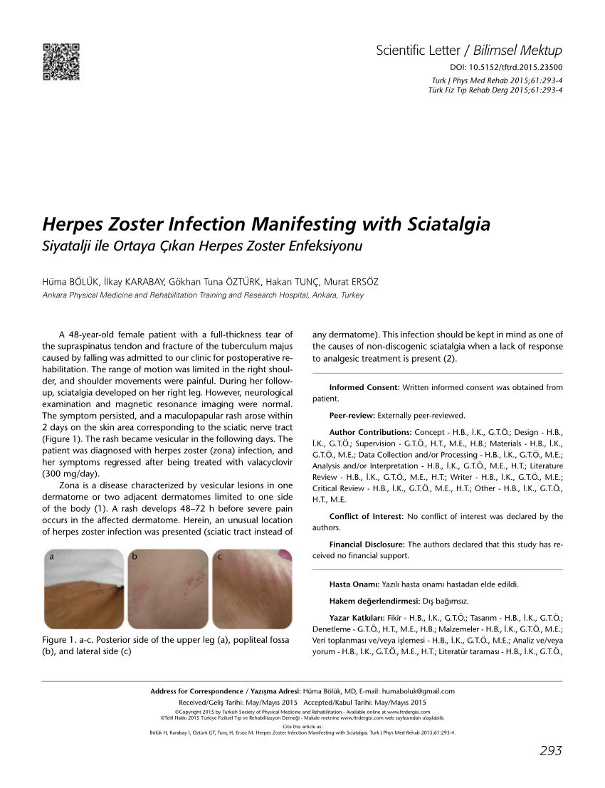 Pdf Herpes Zoster Infection Manifesting With Sciatalgia