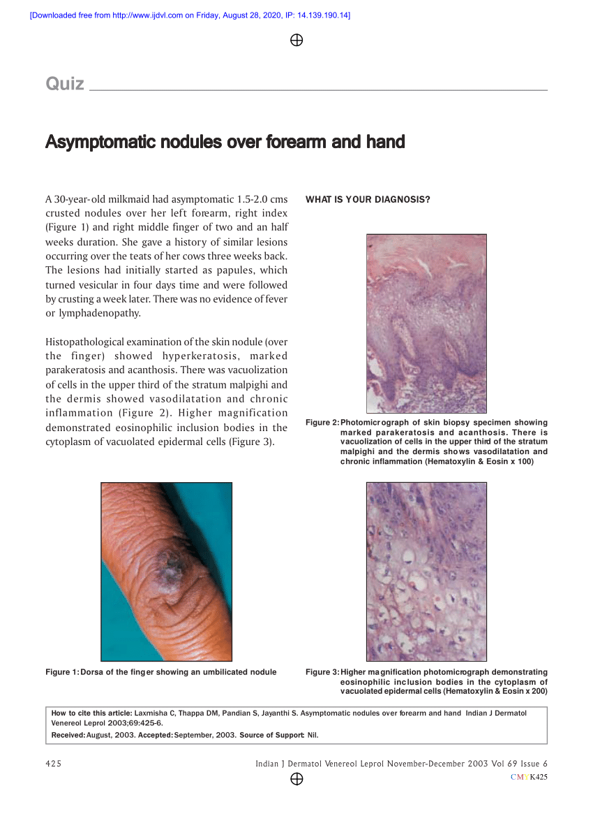 Pdf Asymptomatic Nodules Over Forearm And Hand