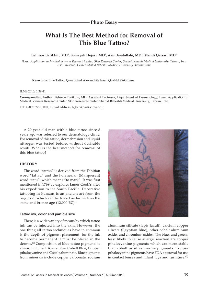 Pdf What Is The Best Method For Removal Of This Blue Tattoo